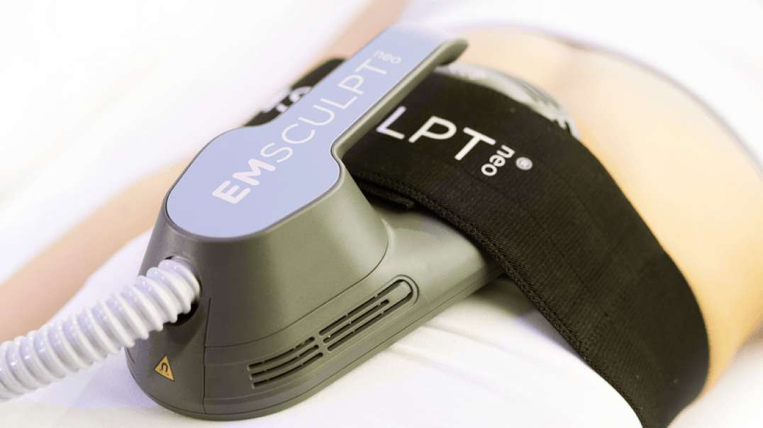 Laser Me : GentleMax Pro in Ballwin, MO